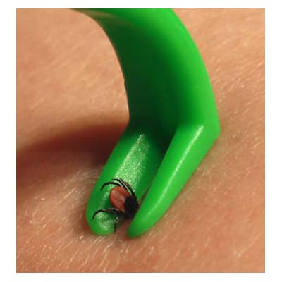 skin hook tick twister