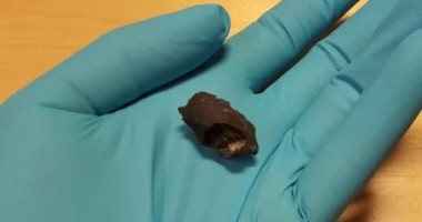 التوصل للحمض النووي البشري في "علكة" عمرها 5700 عام يوضح صفات سكان جنوب السويد والدنمارك 3 201905200222122212 5