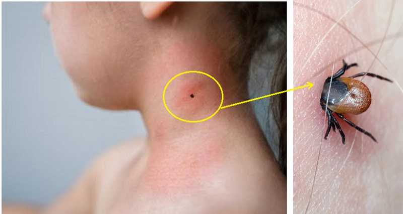 image 3.63365.31865.20221109150004 1