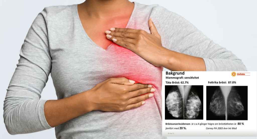 breast cancer symptoms 1