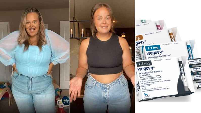 Wegovy Weight Loss Transformation 1