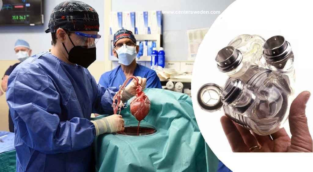 e157514e bbf9 4bbd 9089 3c09f86c6c71 1